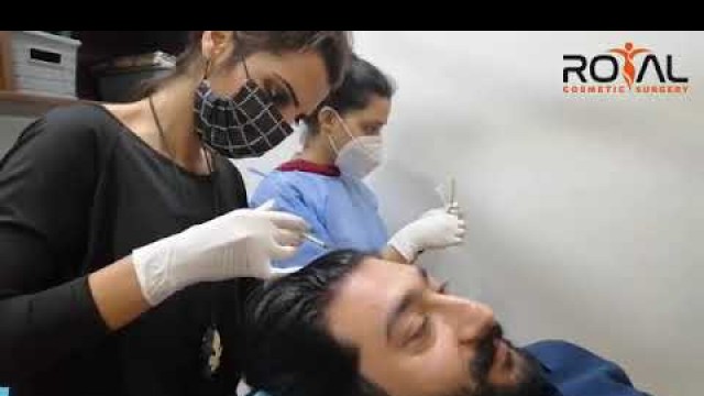 'Zafar Supari Get the PRP Treatment at Royal Cosmetic Surgery Islamabad'