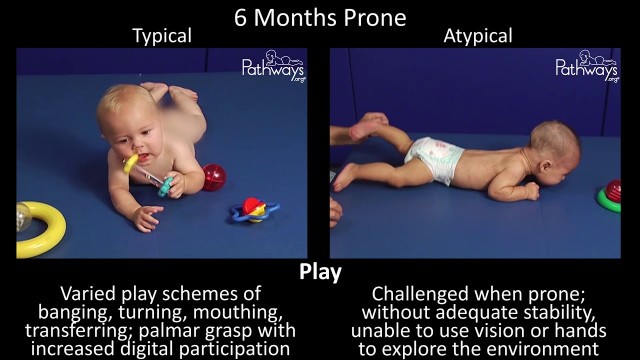 '6 Month Old Baby Typical & Atypical Development Side by Side'