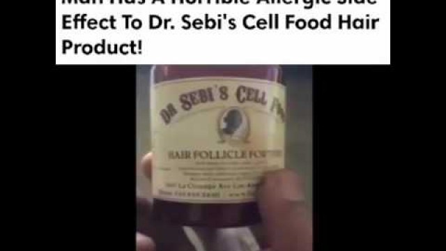 'Dr. Sebi cell food gone wrong. Who\'s man\'s is this!!!'