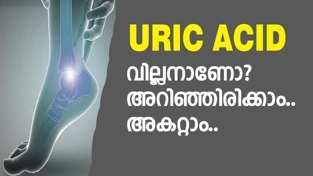 'How to Control and reduce Uric Acid |  symptoms | treatment | diet | Gout | Solution for Uric acid'