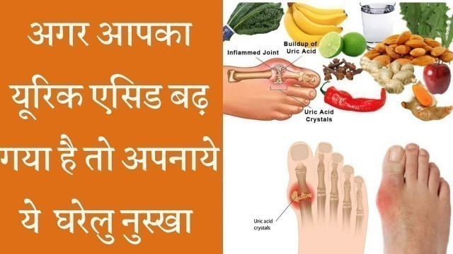 'Amazing Home Remedies to Reduce Uric Acid अगर आपका यूरिक एसिड बढ़ गया है तो अपनाये ये  घरेलु नुस्खा'