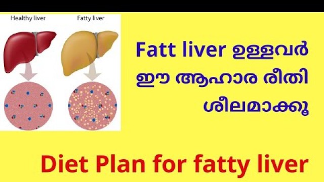 'Fatty liver ഉള്ളവർ ഈ ആഹാര രീതി ശീലമാക്കൂ'